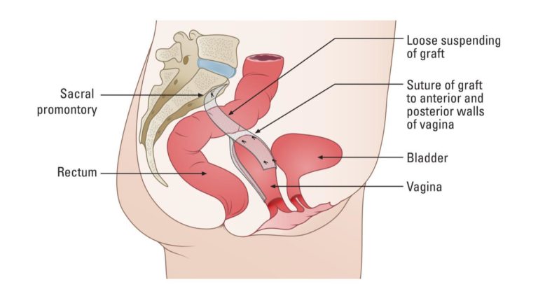 anatomy drawing of female anatomy