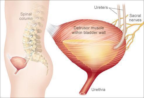 drawing of detrusor muscle within bladder wall