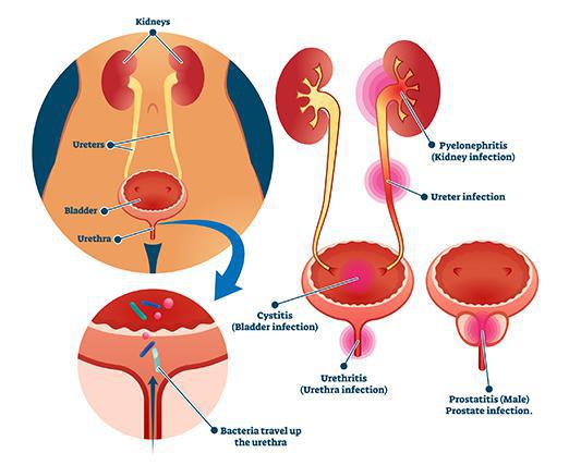 drawing of female urinary tract